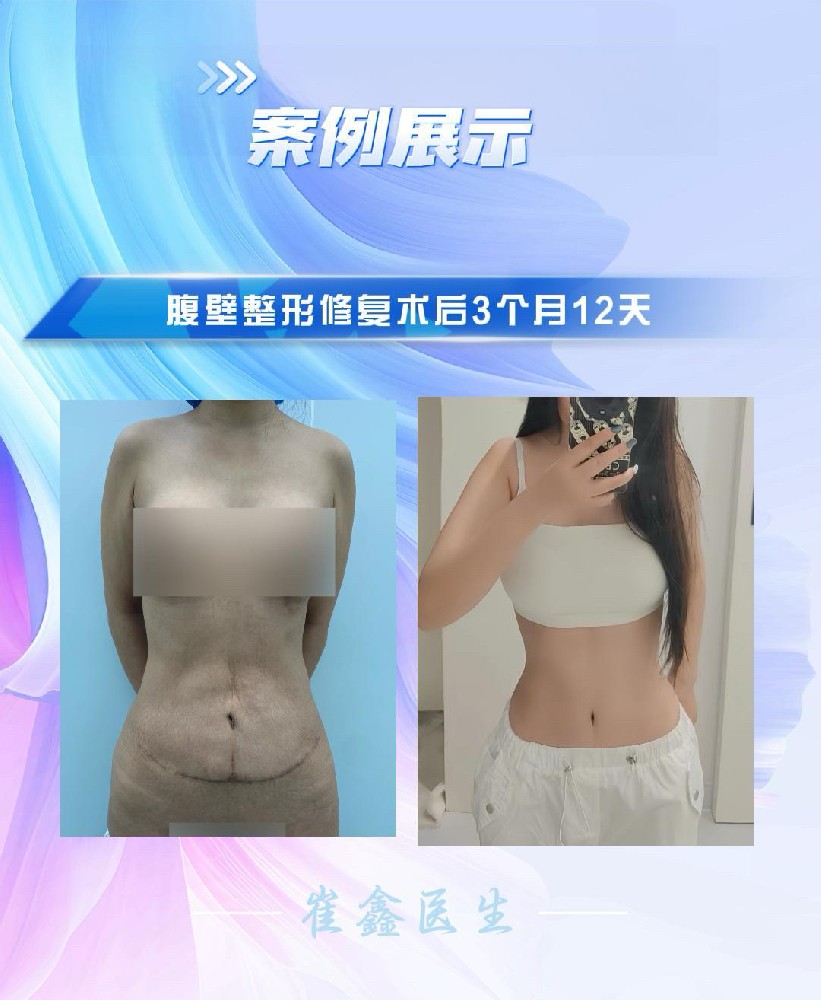 2024 4.12 穆春丽.JPG