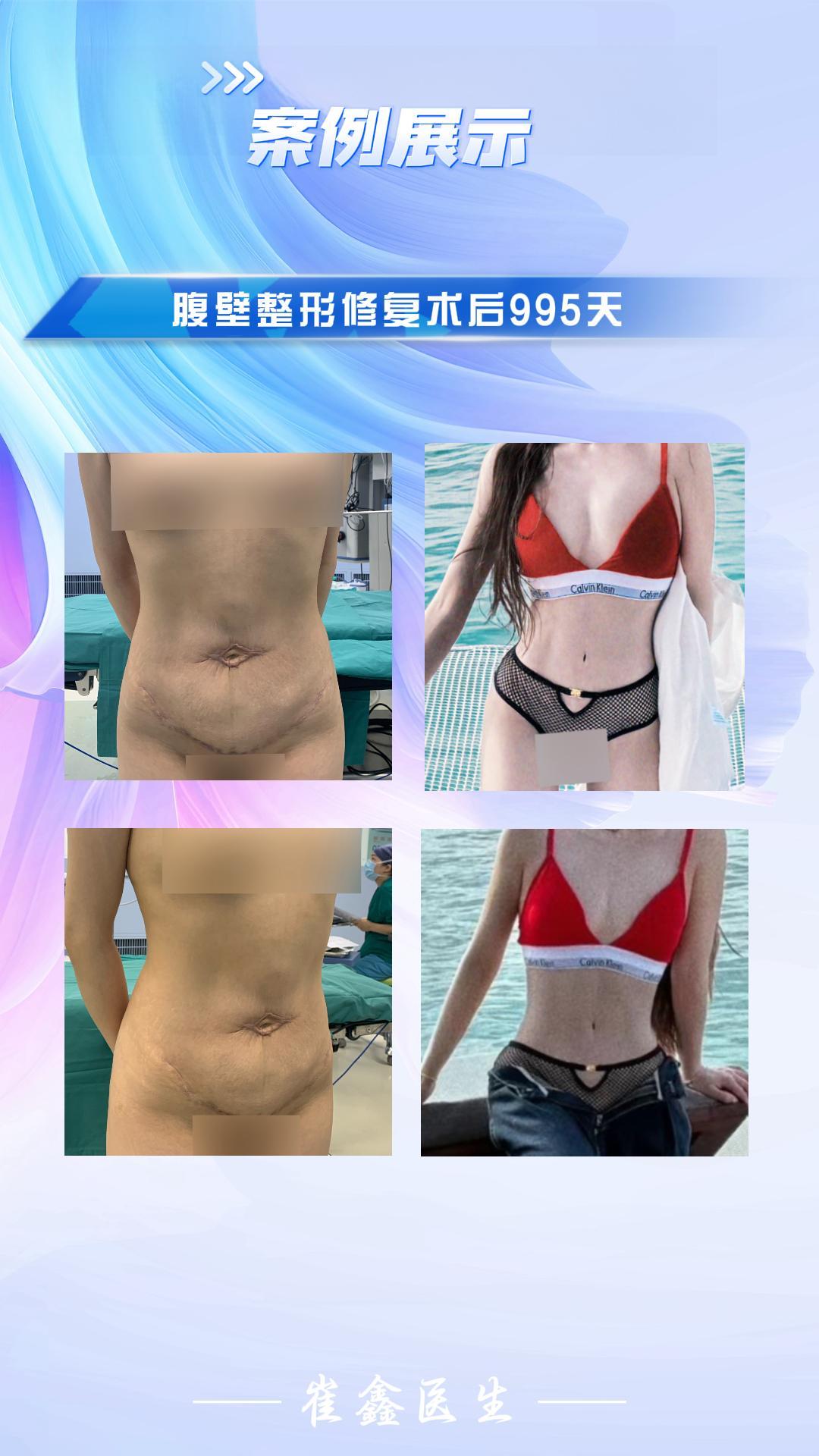 2021 11.3 王亚晨.jpg