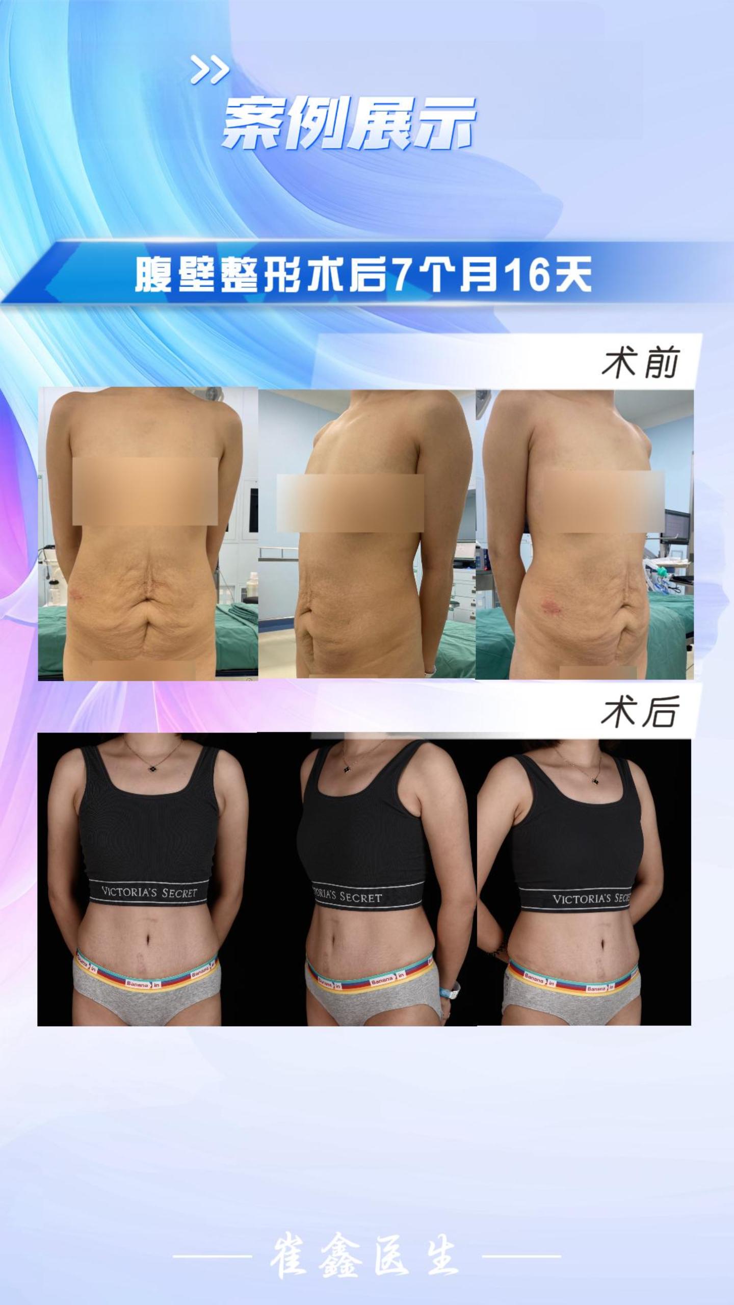 2023 3.16 叶敏.jpg