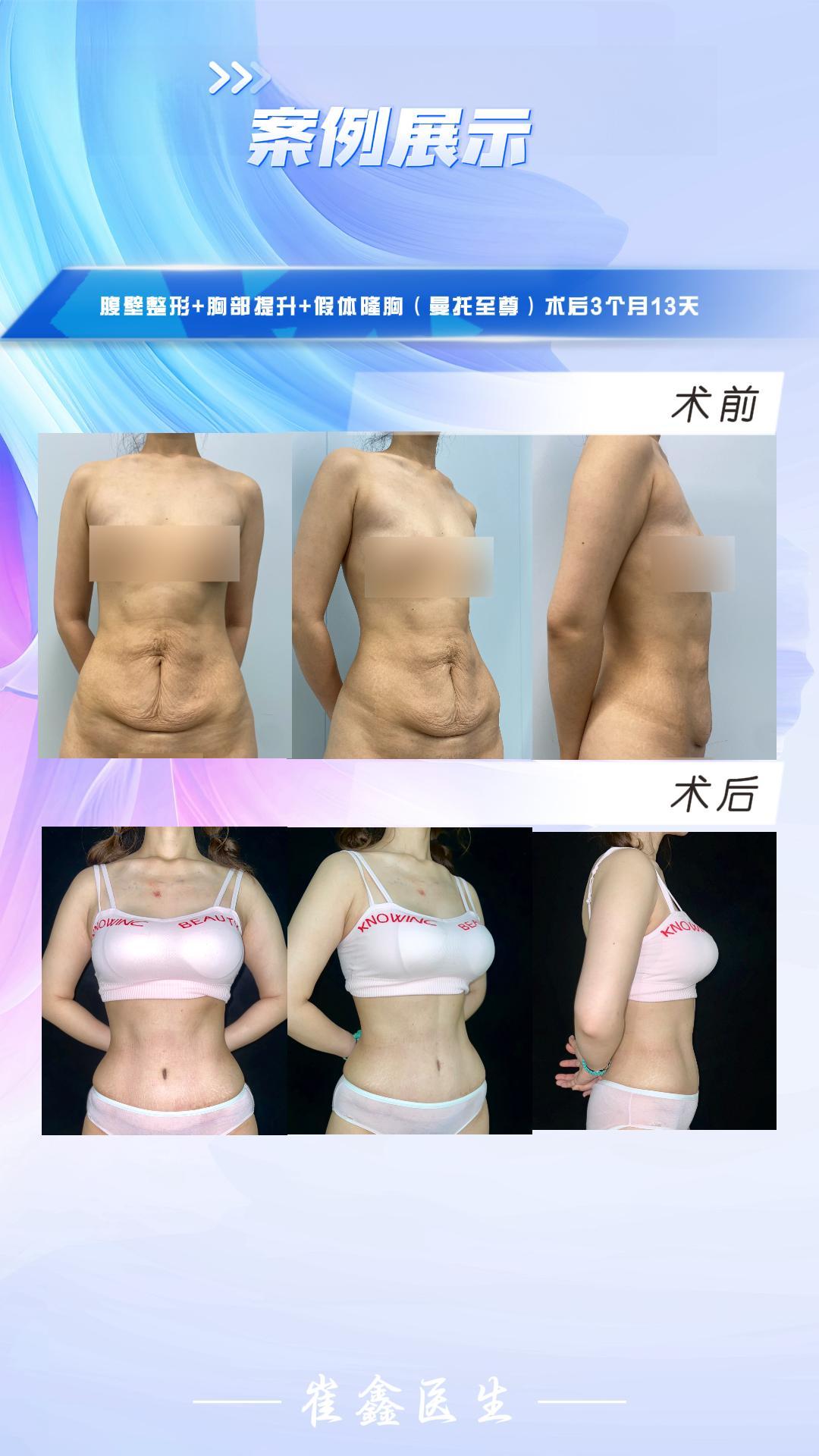 2024 3.20 陈彦橘.jpg