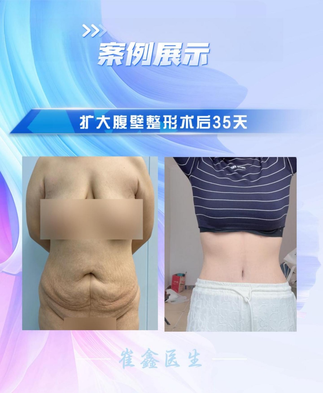 2024 3.25 侯悦_副本.jpg