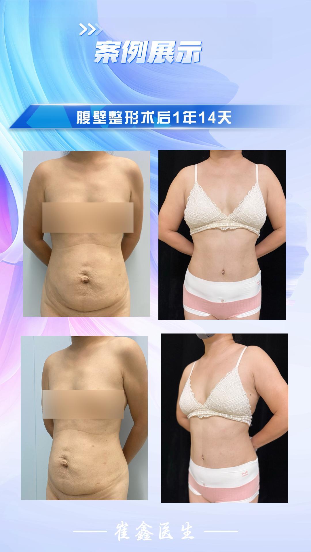 2023 9.25 田菲菲.jpg