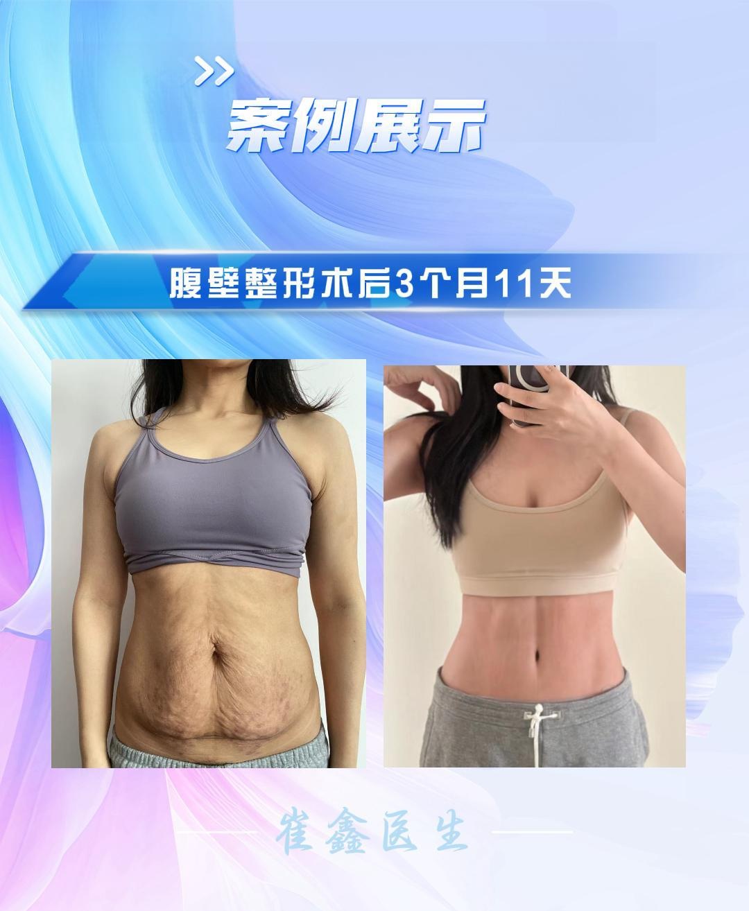 2024 4.15 张安_副本.jpg